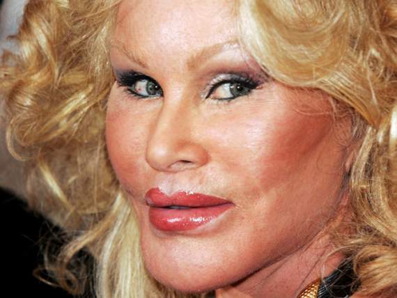 Ugliest-Female-Celebrity-Jocelyn-Wildenstein